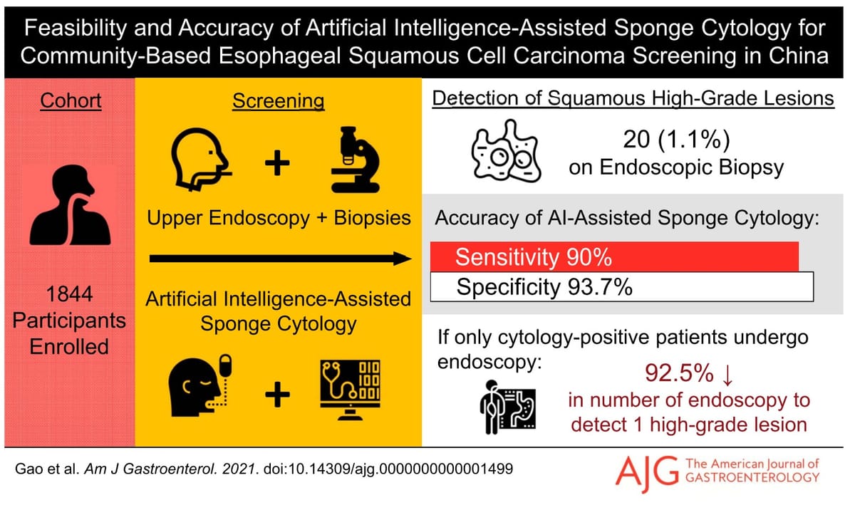 Non-invasive capsule sponge with AI cytology shows promise for screening high-risk areas of China