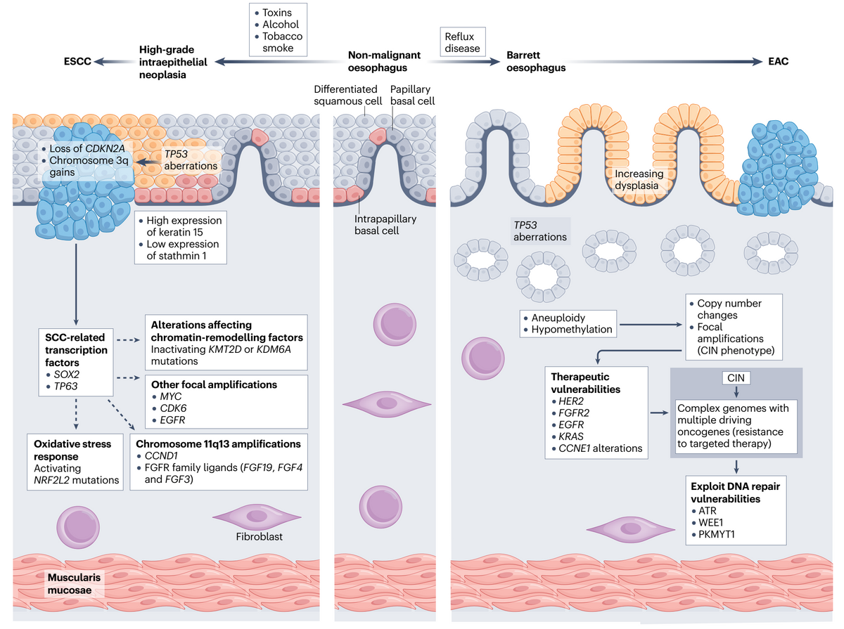 Advances in management of esophageal cancer