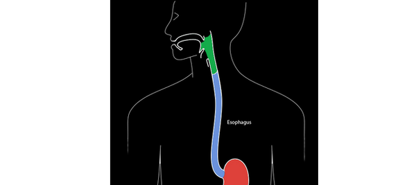 Esophageal cancer background